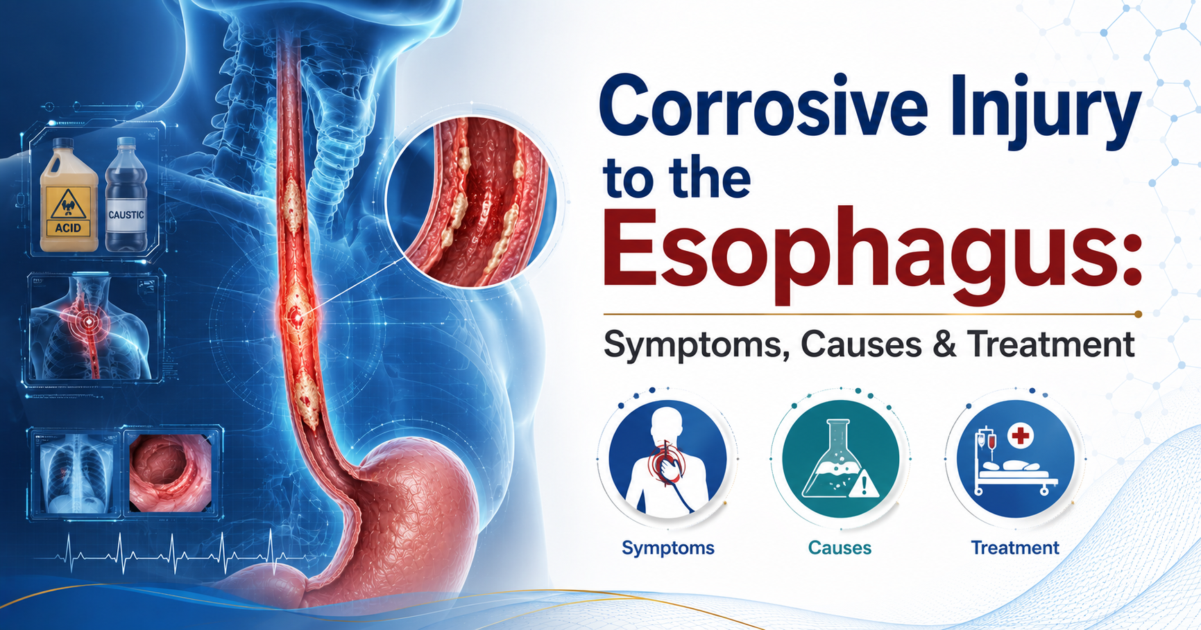 Corrosive Injury to the Esophagus Symptoms, Causes & Treatment