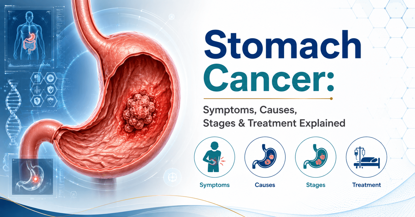 Stomach Cancer Symptoms, Causes, Stages & Treatment Explained